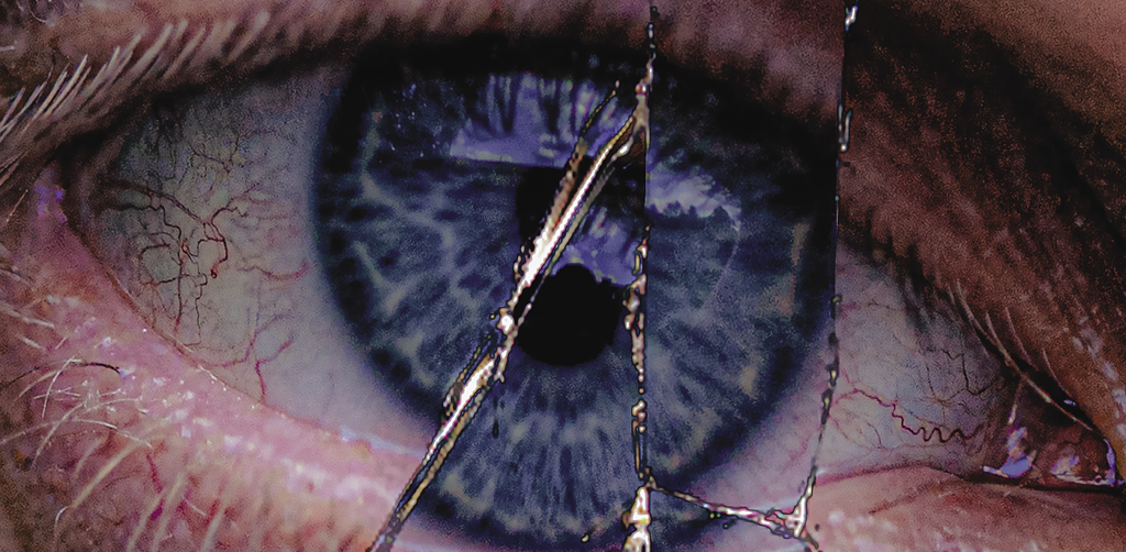 ONE-EYED KING